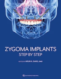 zygomatic arch implants