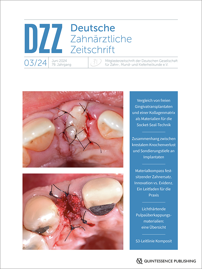 Deutsche Zahnärztliche Zeitschrift, 3/2024