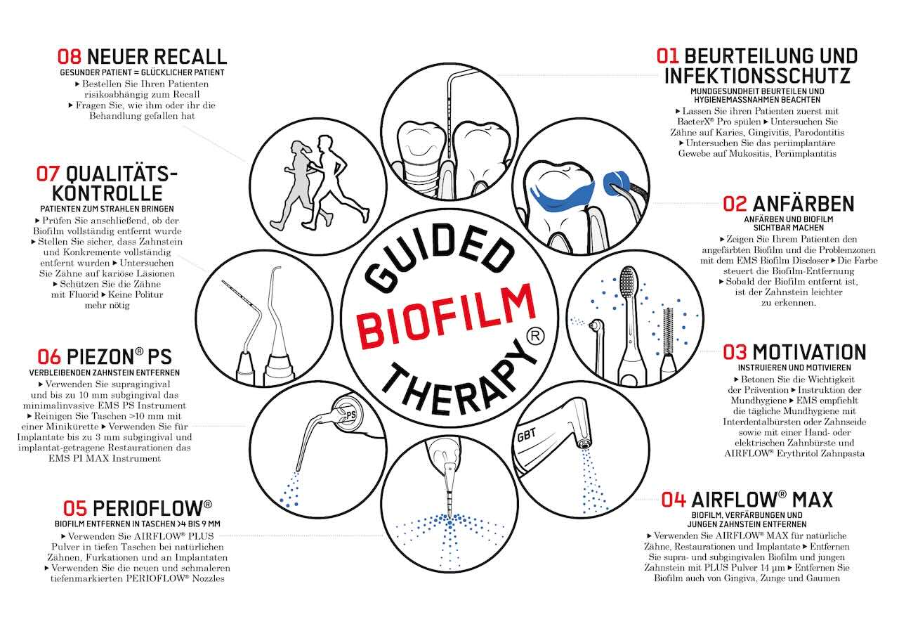 Die Guided Biofilm Therapy ist ein systematisches, modulares, risiko-orientiertes und evidenzbasiertes klinisches Konzept für die professionelle Prophylaxe.