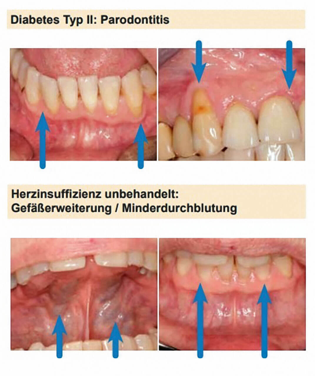 Abb.1 Systematische klinische Einordnung am Beispiel von Diabetes (oben) und Herzinsuffizienz (unten).
