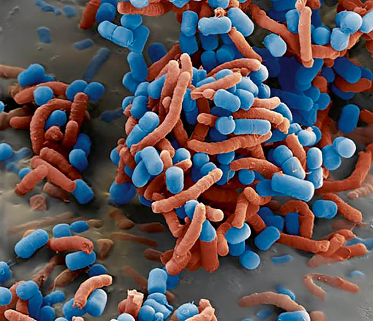 Abb. 2 Lactobacillus reuteri (blau) verklumpt und inaktiviert den Magenkeim Helicobacter pylori (rot) – hier 11.000-fach vergrößert [30].
