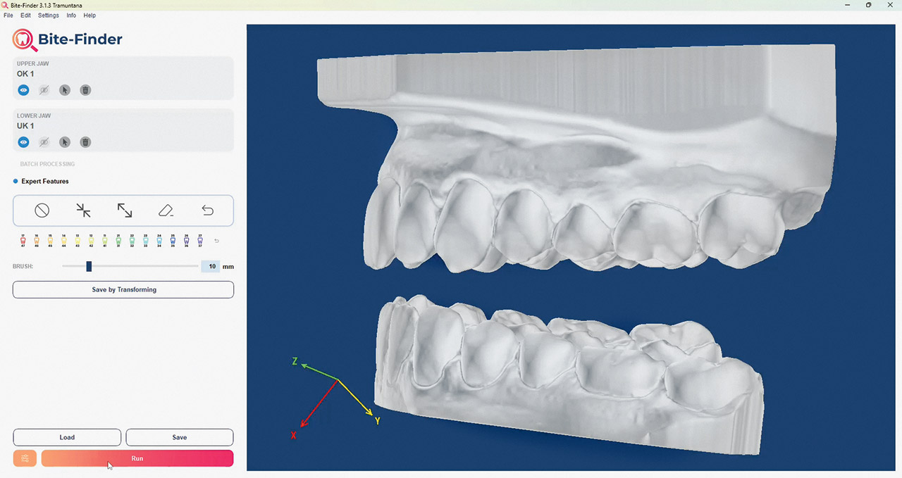 Abb. 1  In die Bite-Finder-Software importierte stl.-files eines Ober- und Unterkiefers.