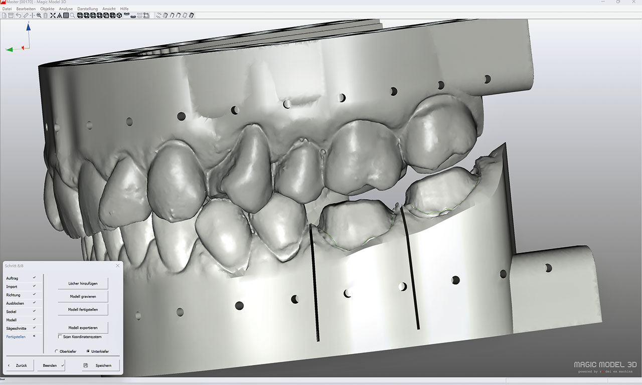 Abb. 3 CAD-Modelle der Zahnkränze mit nicht komplett durchgehenden Sägeschnitten.