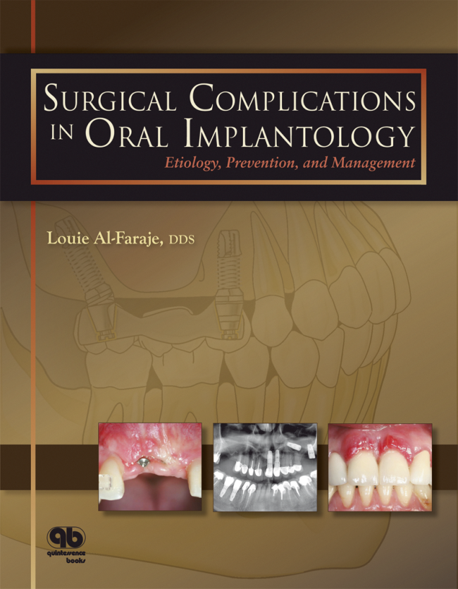 Surgical Complications in Oral Implantology | Louie Al-Faraje