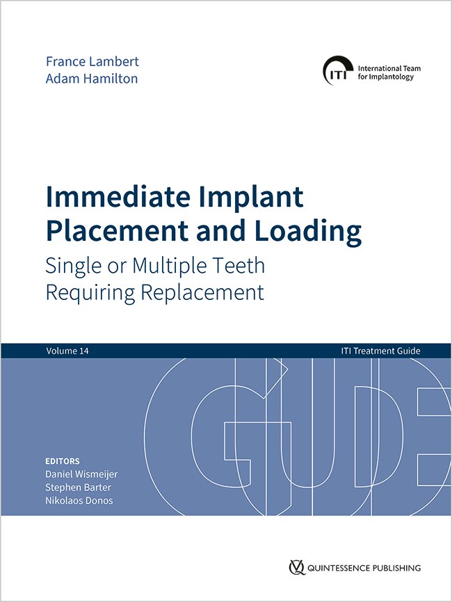 Wismeijer: Immediate Implant Placement and Loading 