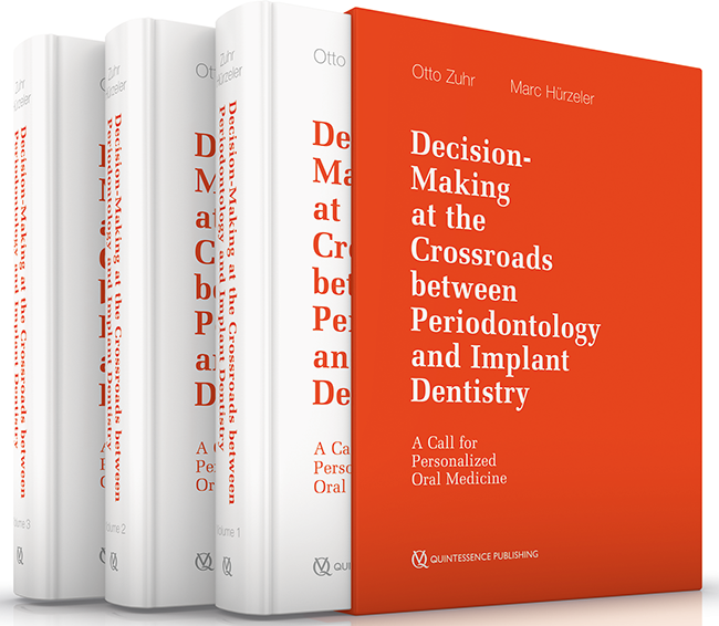 Zuhr: Decision-Making at the Crossroads between Periodontology and Implant Dentistry